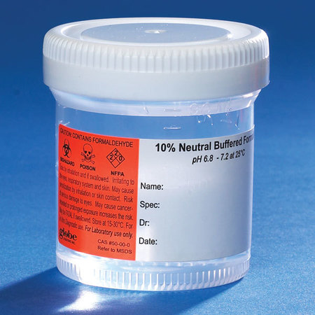 GLOBE SCIENTIFIC Pre-Filled NBF Container, 90mL, PK96 6525FL